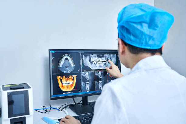 Best Emergency Tooth Extraction in Lemon Grove, CA