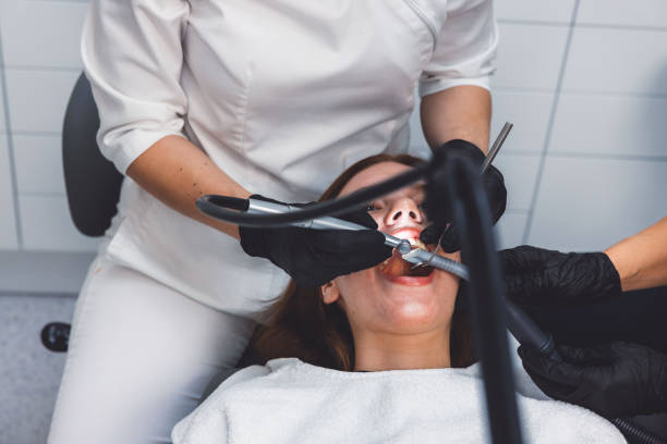 Best Emergency Wisdom Teeth Removal in Lemon Grove, CA
